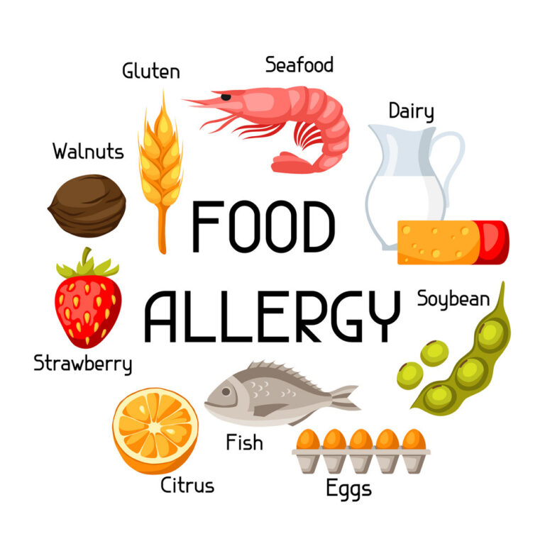 food-allergy
